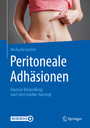 Peritoneale Adhäsionen - Fasziale Behandlung nach dem Liedler-Konzept